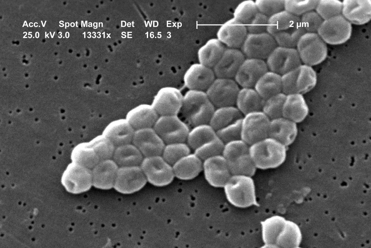 La Acinetobacter baumannii puede causar infecciones en el tracto urinario y heridas en la piel.Pacientes con bajo nivel de defensas son los más susceptibles a contagiarse. Foto: Wikipedia