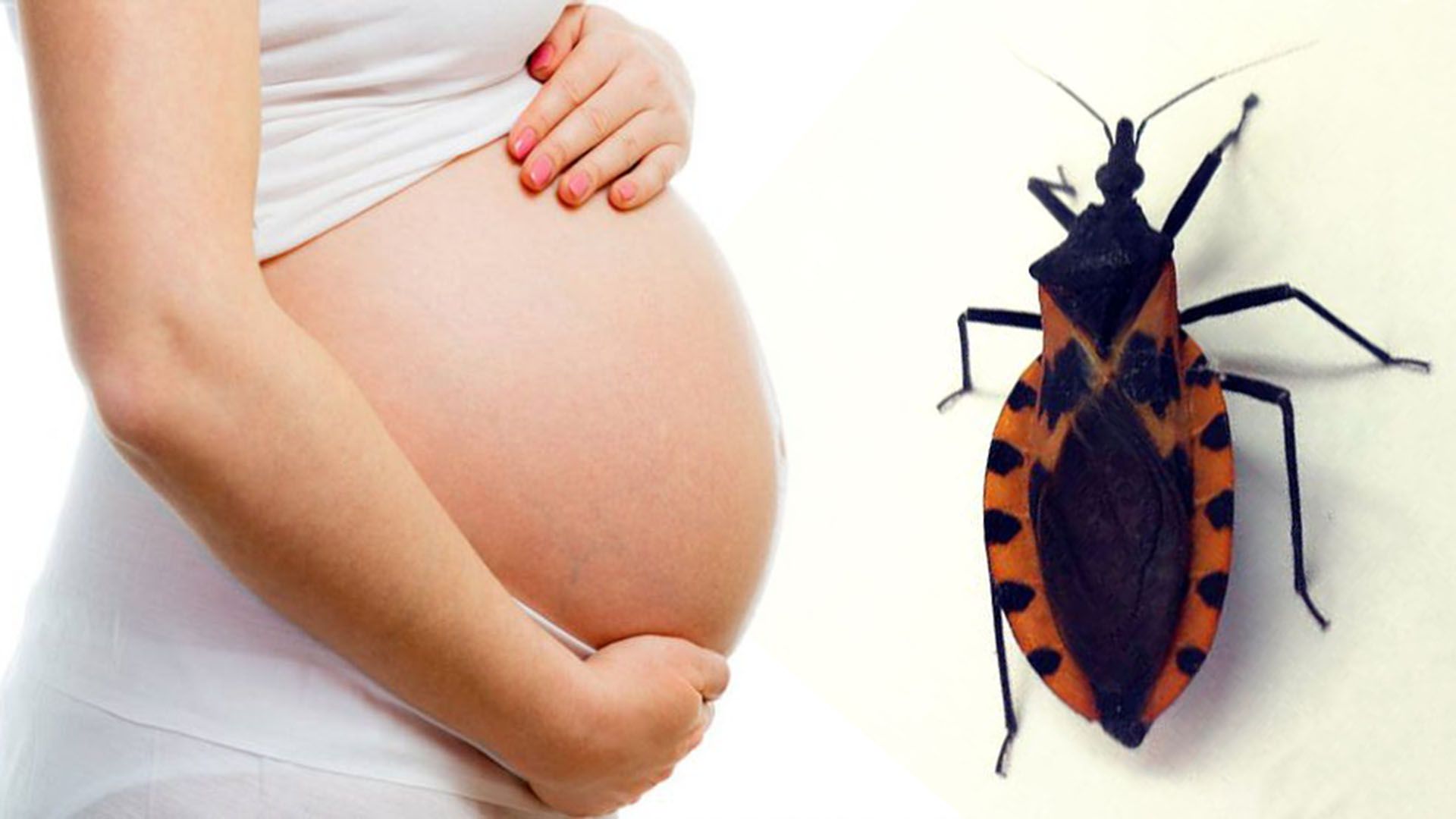 El Chagas es una enfermedad asintomática que debe ser detectada antes o durante el embarazo