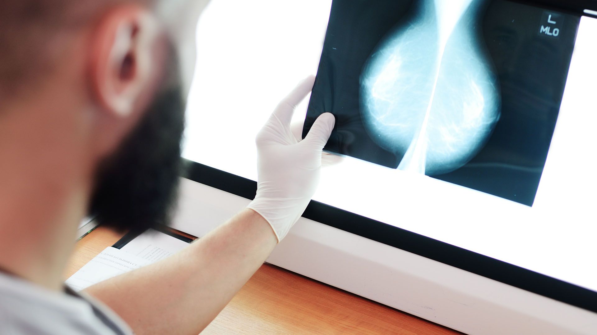 En 2018, se registraron en el país 21.558 nuevos casos de cáncer de mama (Shutterstock)