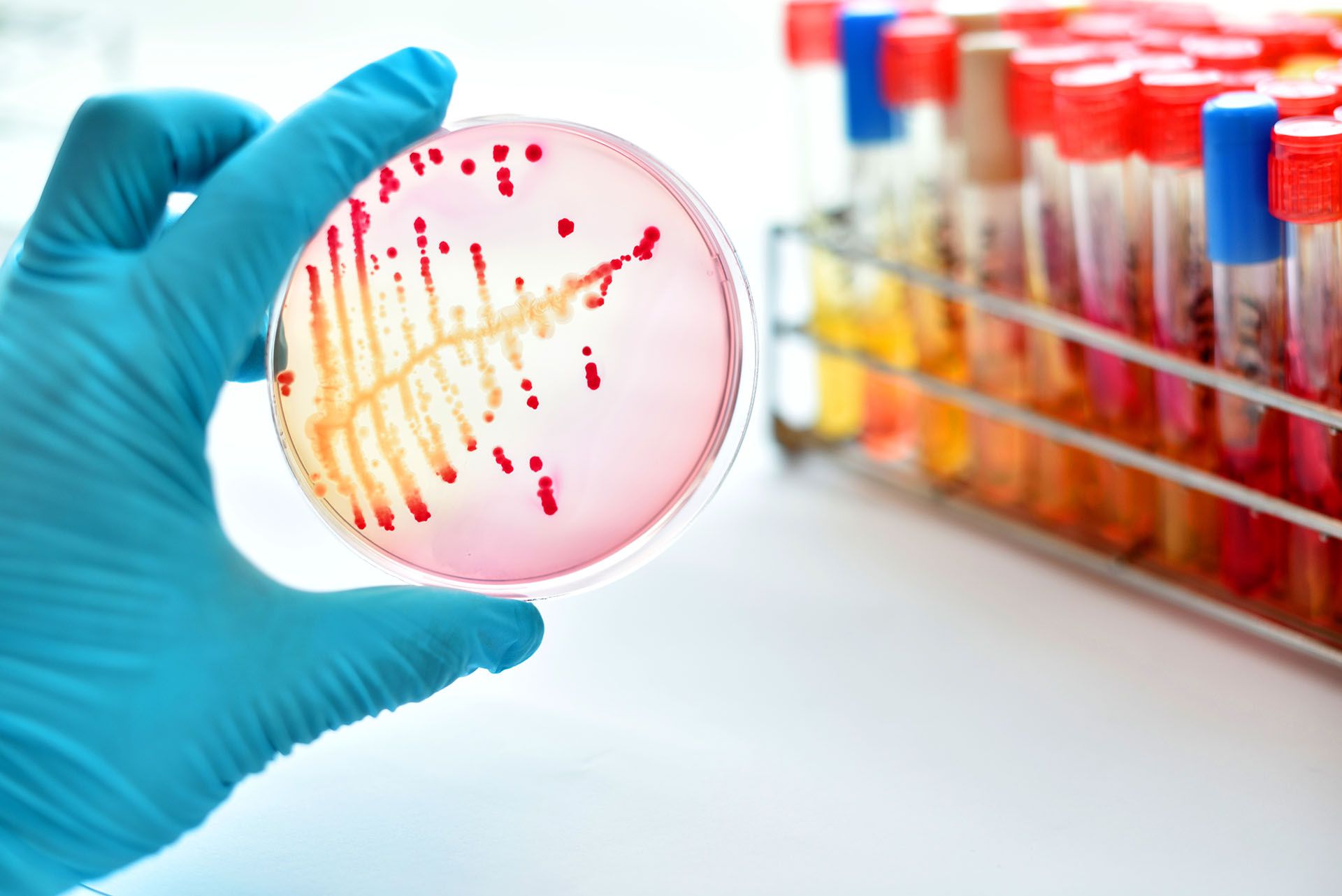 Si bien la neumonía puede ser producida por virus y hongos, generalmente es causada por bacterias, entre las cuales la más común es el neumococo (Shutterstock)