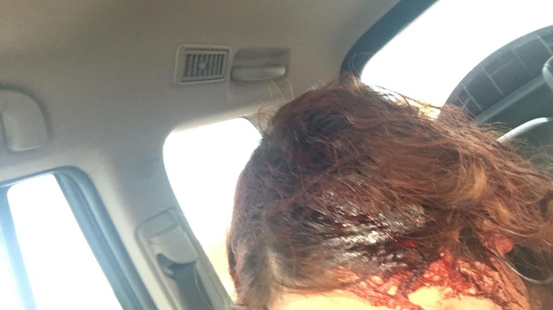 Daniela (18) fue atacada a hachazos por un hombre a la salida de un boliche de Río Grande, Tierra del Fuego.