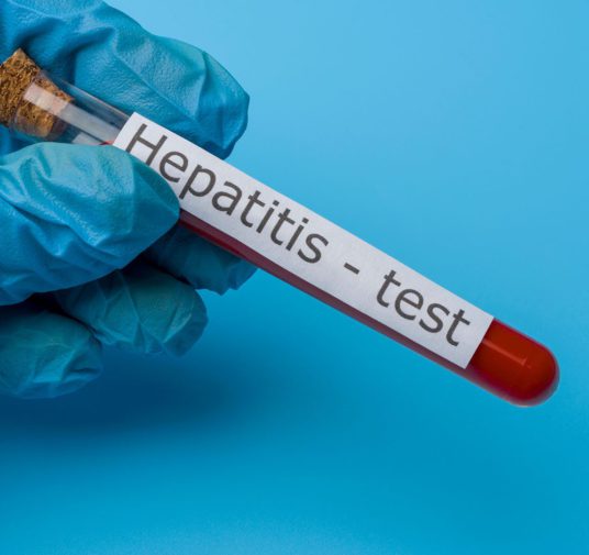 Crisis de hepatitis A se dispara en Estados Unidos: Filadelfia y Florida declararon emergencia