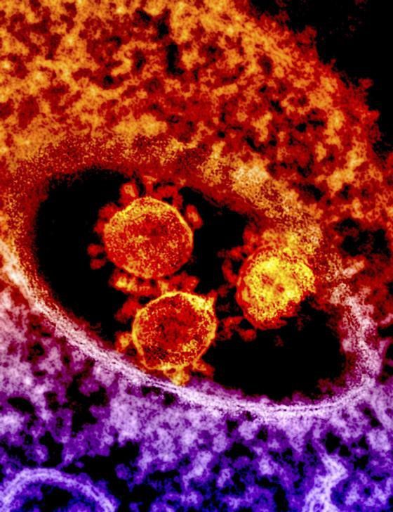 Las partículas un tipo de coronavirus se ven en una fotografía microscópica electrónica coloreada sin fecha del Instituto Nacional de Alergias y Enfermedades Infecciosas (NIAID, por sus siglas en inglés). 2 de mayo de 2014. National Institute for Allergy and Infectious Diseases/Handout vía Reuters.