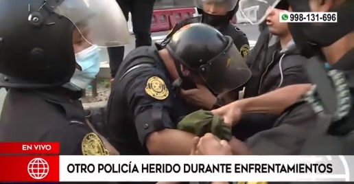 Policía herido en el brazo. (Foto: Captura TV / América TV)